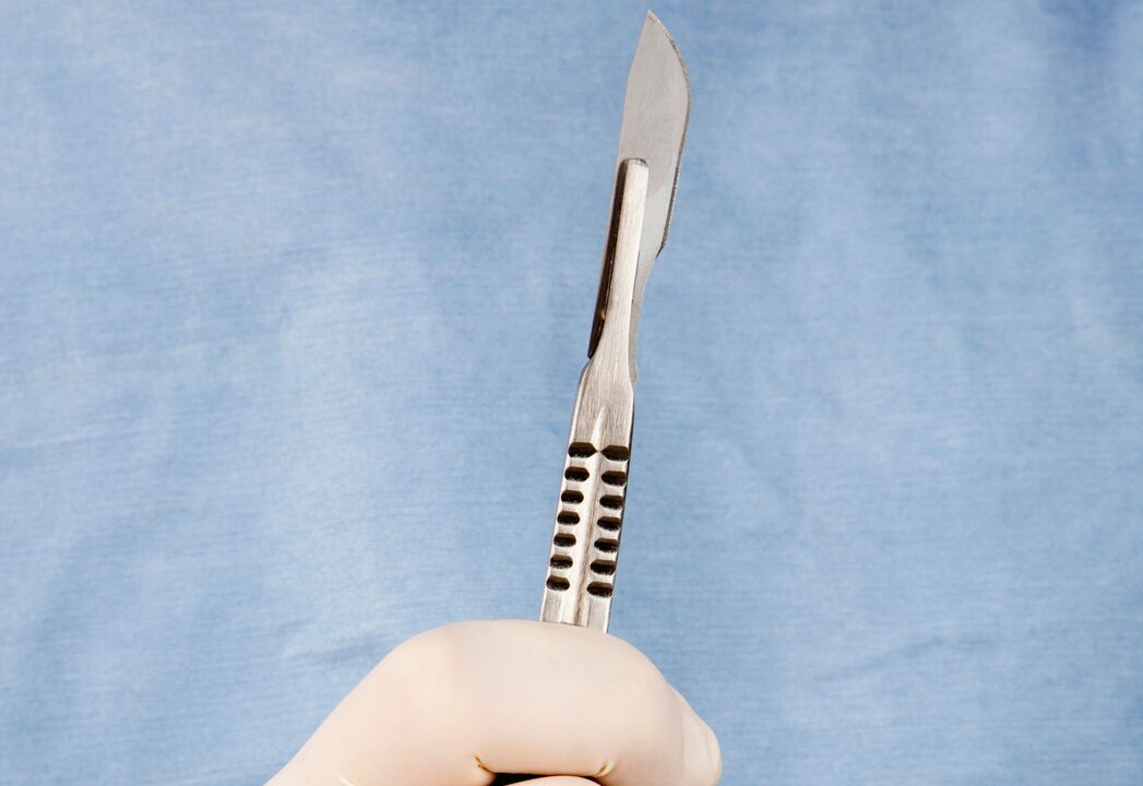 Skalpell fir Penis Erweiderung Chirurgie